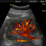 Doppler Abdominal ($ARS)